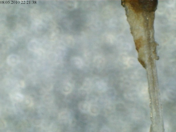 Digital microscope - hair root